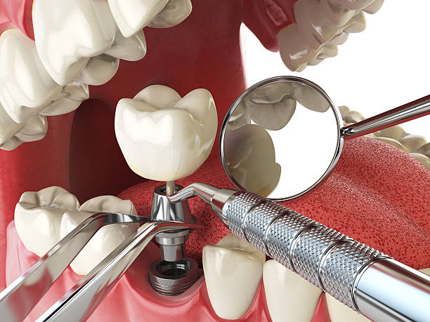 Best Emergency Dental Surgery in De Soto, KS